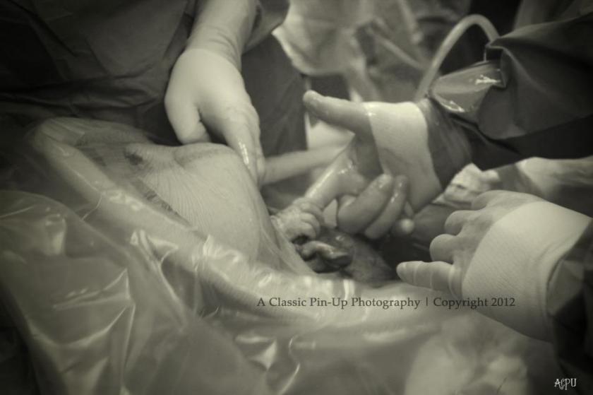 תוצאת תמונה עבור ‪Baby In Womb Grabs Doctor's Finger‬‏