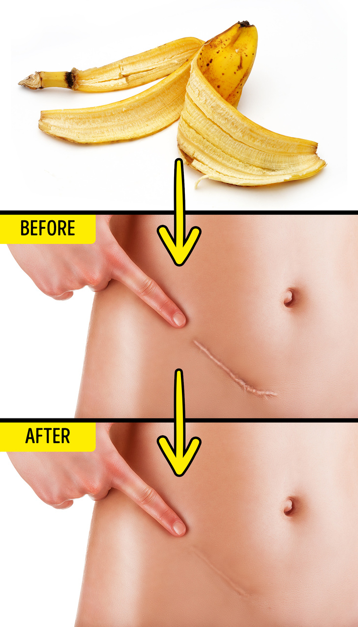 10 Unusual Ways to Use Banana Peels