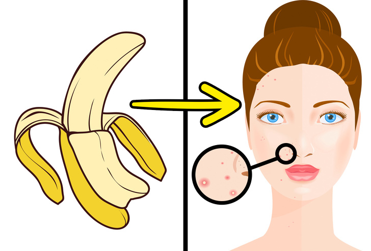 10 Unusual Ways to Use Banana Peels