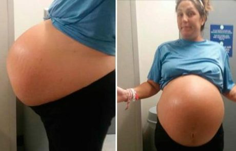 אמא ממהרת לבית חולים ללדת: ואז הרופאים רואים מה יש לה בבטן ולא מאמינים
