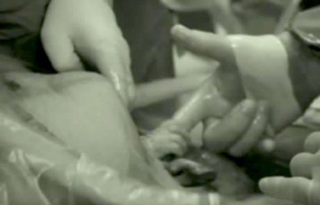 מדהים! תינוקת שנולדה בניתוח קיסרי הושיטה יד מהרחם ותפסה את אצבעו של הרופא!