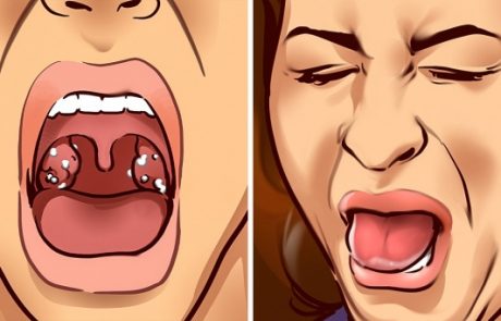 9 דברים שטעם רע בפה מנסה לגלות לך בעקבות סכנות שבגופך